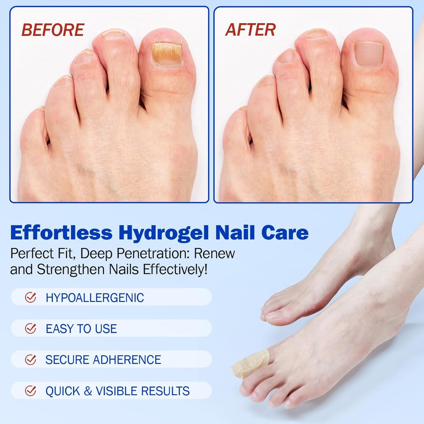 Fungal Nail Patches - 21 Toe Nail Care Patches
