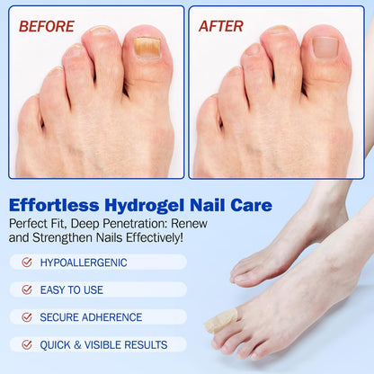 Fungal Nail Patches - 21 Toe Nail Care Patches