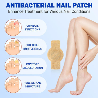 Fungal Nail Patches - 21 Toe Nail Care Patches